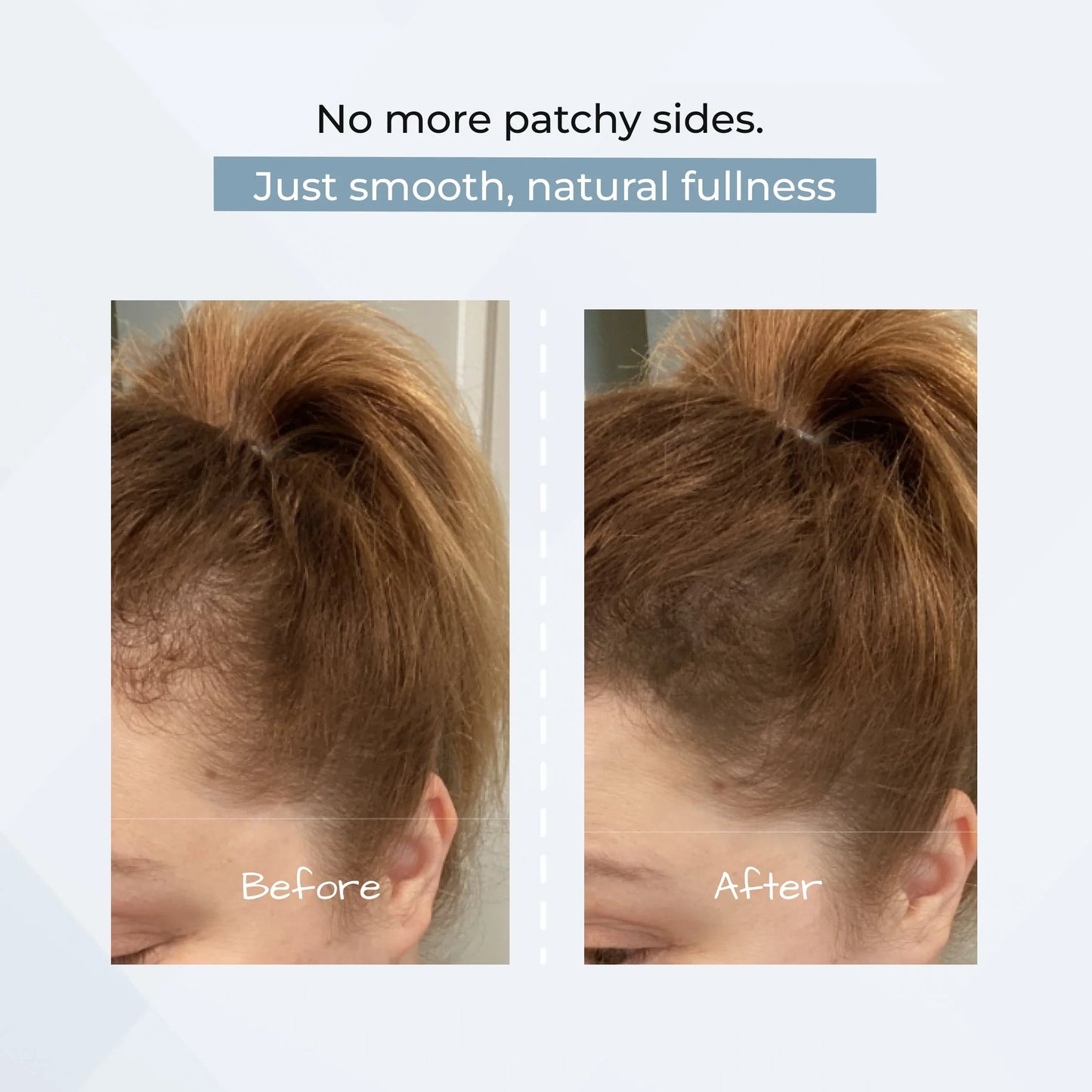 HairShadow – Instant Coverage & Natural Volume Powder