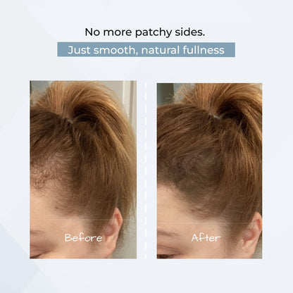 HairShadow – Instant Coverage & Natural Volume Powder